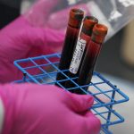 Blood test may determine severe COVID-19 cases, risk of death: study