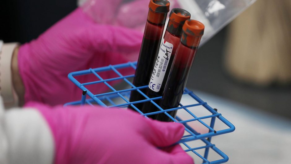 Blood test may determine severe COVID-19 cases, risk of death: study