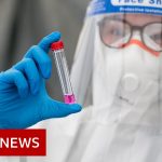 Coronavirus: WHO records highest global cases in 24 hours – BBC News