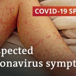 Coronavirus suspected of causing rare childhood disease | COVID-19 Special