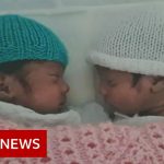 Woman in Covid coma gives birth to twins – BBC News