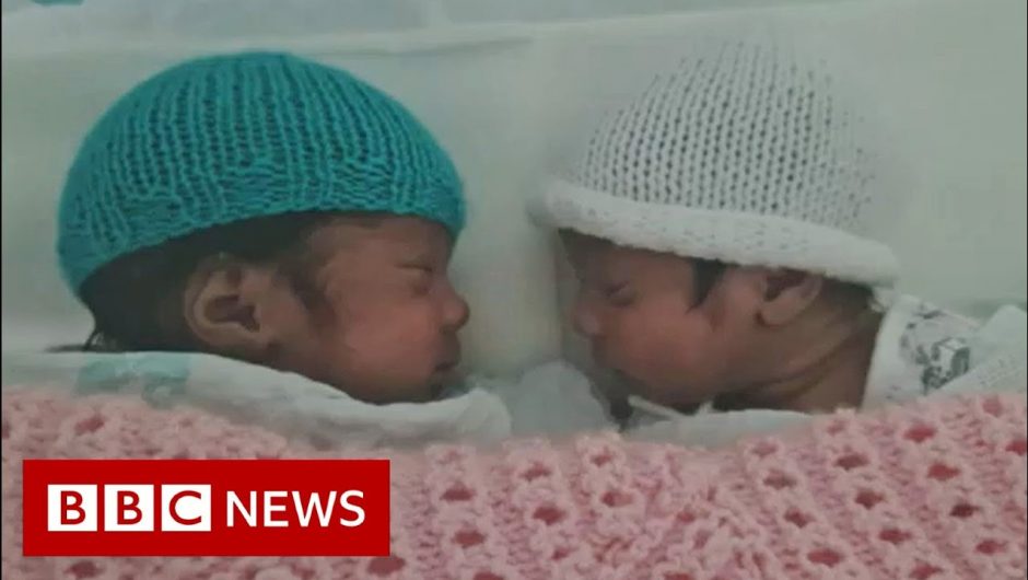 Woman in Covid coma gives birth to twins – BBC News